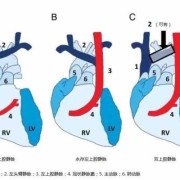 胎儿永存左上腔（永存左上腔静脉是什么意思啊）