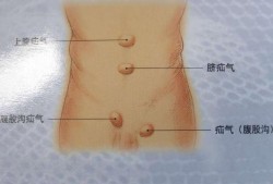 小孩疝气怎么治,胎儿肠疝是什么意思