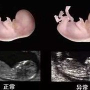 怎样检查小孩智商,胎儿智力筛查是做什么检查