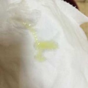 孕妇白带发黄对胎儿吗（孕妇白带发黄正常吗）