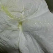 孕期白带黄稠（白带发黄粘稠是怎么回事）