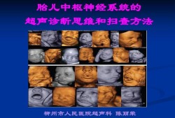 胎儿神经系统发育异常的表现（胎儿神经系统发育异常的表现）