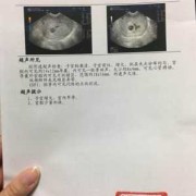 孕囊偏大跟孕期对不上（孕囊偏大跟孕期对不上求原因）