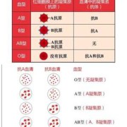 胎儿abo溶血（新生儿abo溶血症黄疸是什么）