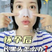 孕期如何去黑头（孕期如何去黑头）
