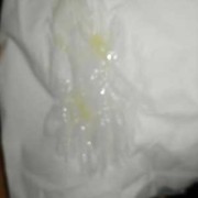 孕期鼻涕多（孕期鼻涕多是怎么回事）