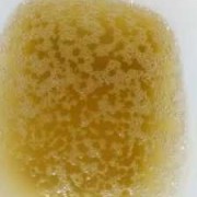 孕期晨尿红（孕期晨尿红茶色是怎么回事）