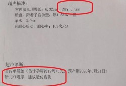 胎儿nf（有懂孕期NF增厚的大神吗）