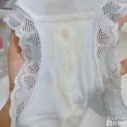 孕妇有白带属于是正常的吗,