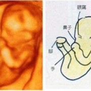 胎儿24周630克正常吗,怀孕24周的胎儿图片视频