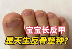 甲影响胎儿（反骨甲宝宝怎么教育）