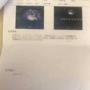 怀孕4个月胎心位置,四个月胎儿会动了吗?