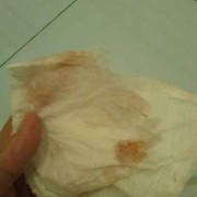 怀孕早期出少量血对胎儿发育有影响吗？要注意什么,早孕期间少量出血是怎么回事