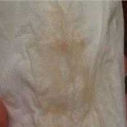 孕期褐色分泌物的图片（有褐色血说明胚胎已经生化吗）