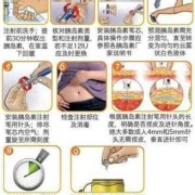 孕期胰岛素怎么打（孕期打胰岛素可以吗）