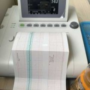 胎儿电子监护（EICU是什么意思）
