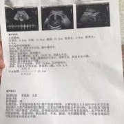 胎儿头偏大怎么办（35周胎儿头偏大怎么办）