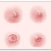 哺乳期怀孕还会有奶水吗,孕期乳分泌物正常吗
