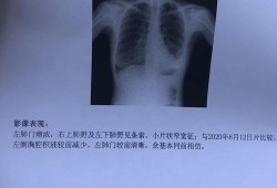 胎儿肺积水（胎儿肺积水是怎么引起的）