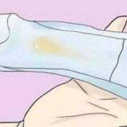 孕期水样分泌物（水样分泌物是怎么回事）