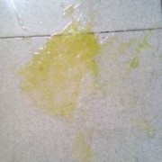 孕吐吐到最后吐黄水，又苦又酸，怎么回事，吐的黄水是什么,孕期吐的酸水怎么回事