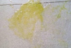 孕吐吐到最后吐黄水，又苦又酸，怎么回事，吐的黄水是什么,孕期吐的酸水怎么回事