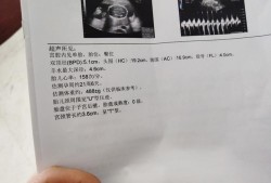 胎儿脖子上有U型压痕（胎儿脖子上有U型压痕）