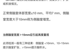 胎儿左侧侧脑室高值（胎儿侧脑室宽度正常值是多少）