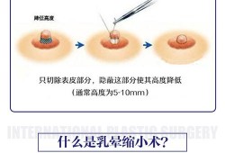 母乳喂奶乳头破皮流血了怎么办,孕期乳晕破皮流水抹乳汁有用吗