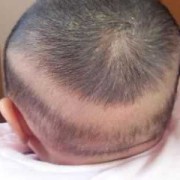 胎儿多少周开始长头发（为啥宝宝头顶的头发长得快）