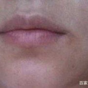 孕期嘴角发黑（【嘴角发黑去掉方法有哪些】）