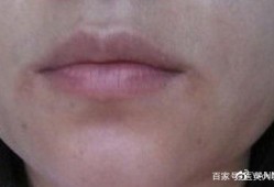 孕期嘴角发黑（【嘴角发黑去掉方法有哪些】）