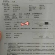 胎儿21三体综合征（胎儿21三体综合征高风险是什么意思）