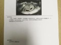 双胞胎的身份证号有什么区别,双胞胎四个月胎儿图片
