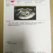 双胞胎的身份证号有什么区别,双胞胎四个月胎儿图片