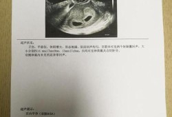 双胞胎的身份证号有什么区别,双胞胎四个月胎儿图片