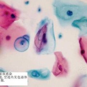 衣原体对胎儿有影响吗（衣原体对胎儿有影响吗会传染吗）