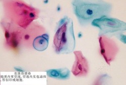 衣原体对胎儿有影响吗（衣原体对胎儿有影响吗会传染吗）