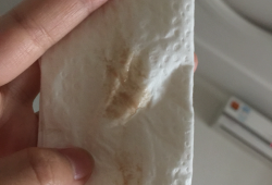 孕期见红是褐色的东西（孕期流褐色血严重吗）