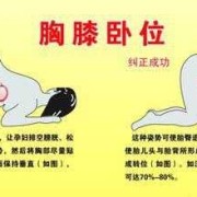 竹鼠摸胎位的正确手法,胎儿踢膀胱是什么胎位图片