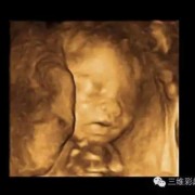 胎儿超声波检查是什么（胎儿系统超声检查和四维是一回事儿吗）