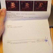泌尿系统感染的检查方法,胎儿泌尿系统怎么检查最准确