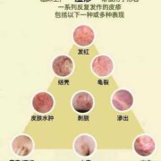 皮肤过敏会影响胎儿吗（皮肤过敏会影响胎儿吗知乎）