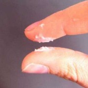 怀孕期间有白带（怀孕期间有白色分泌物正常吗?）