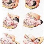 分娩是胎儿（分娩是胎儿）