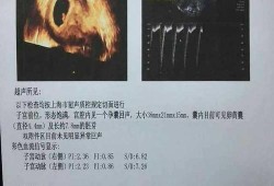 怀孕两次一开始有胎心胎芽后来没了咋回事啊,为什么胎儿会没有胎心胎芽
