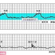 胎儿心跳（胎儿心率快怎么回事）