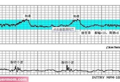 胎儿心跳（胎儿心率快怎么回事）