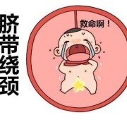 孕宝宝脐带绕颈怎么办？脐带绕颈对胎儿有什么坏处,胎儿脐带绕腹有影响吗图片