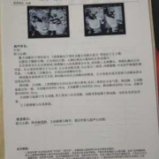 胎儿主动脉大于肺动脉（胎儿肺动脉与主动脉内径比例偏小是什么意思）